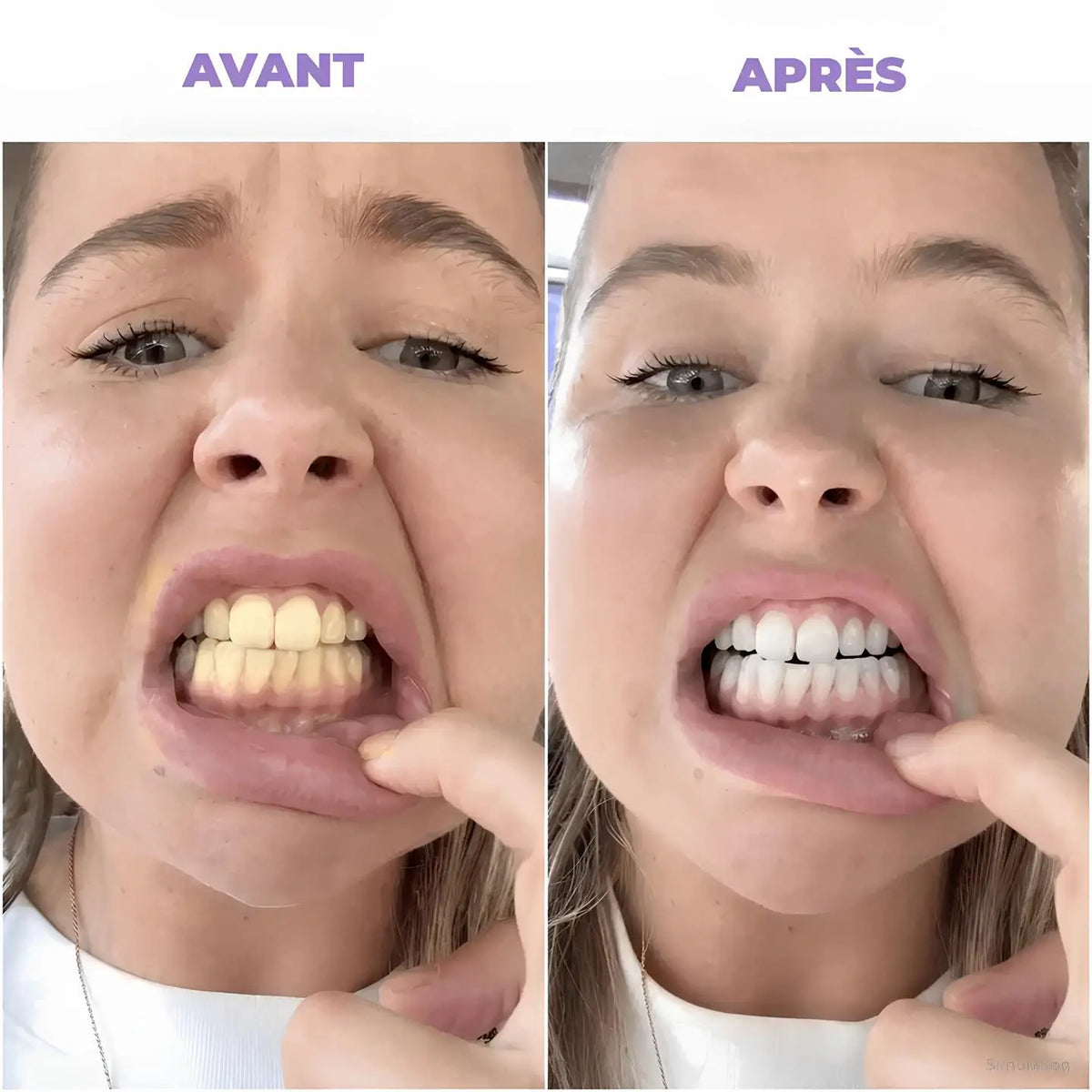 Bain de Bouche Blanchissant | DR.Dentis